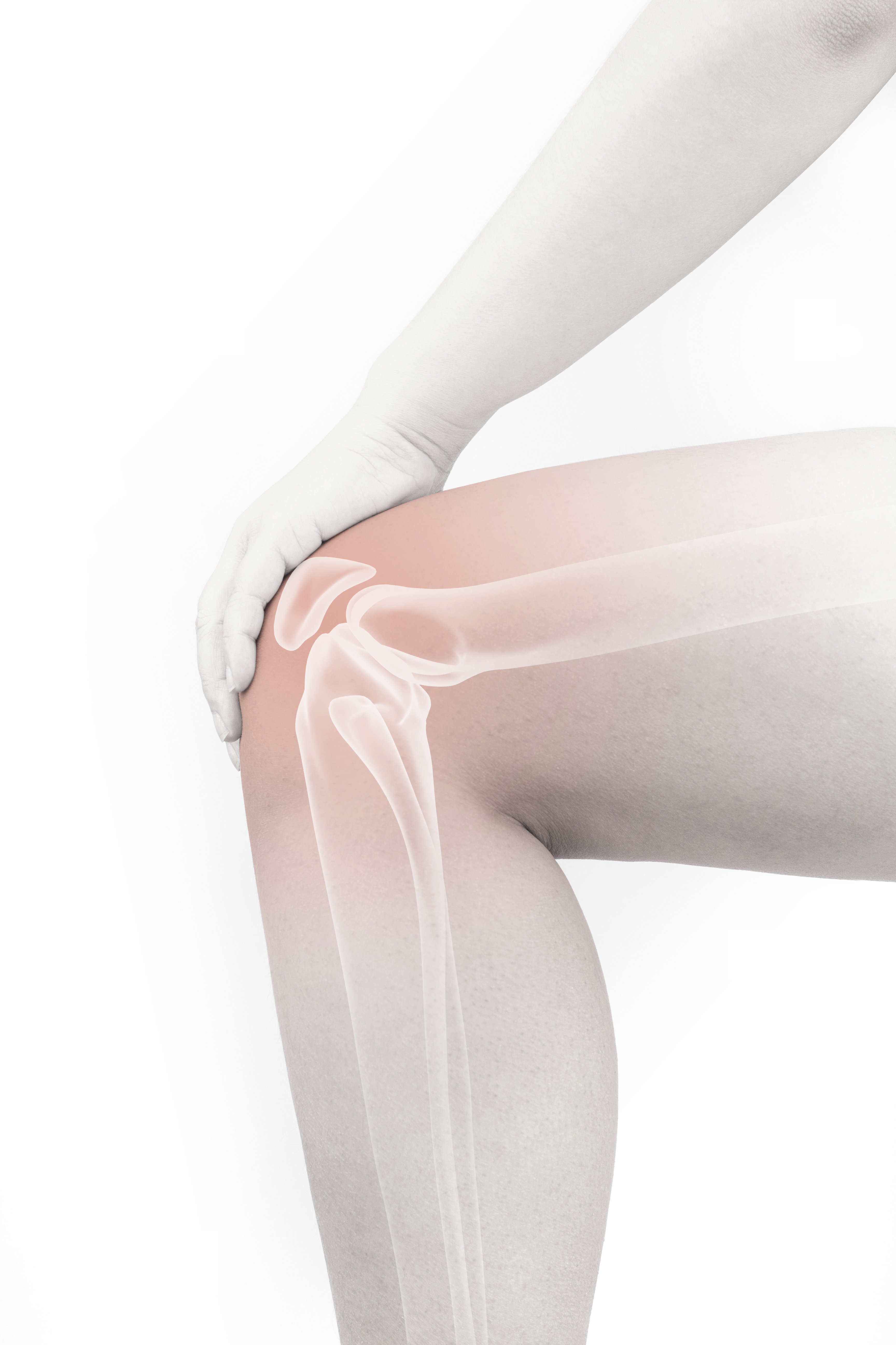 Privatarztpraxis Integrative Medizin – Chondropathie, Gelenkarthrose und Osteochondrose bei Sportler. Neuraltherapie in Braunschweig.